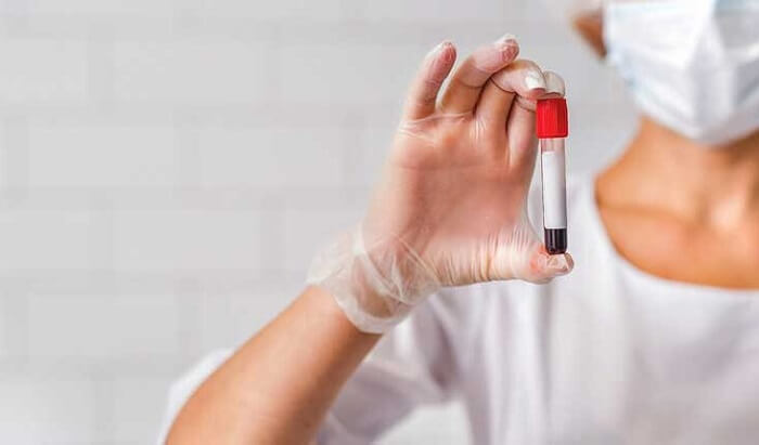 O número crescente de casos de sífilis em Manaus gera preocupação nas autoridades: 