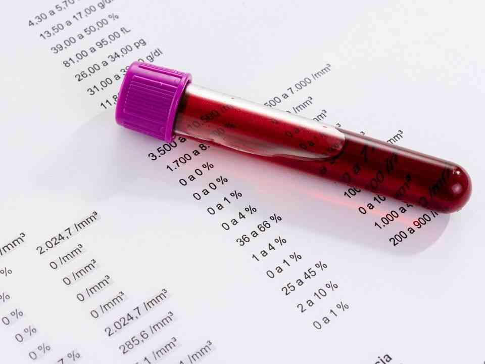 Como se preparar para exames laboratoriais e evitar erros