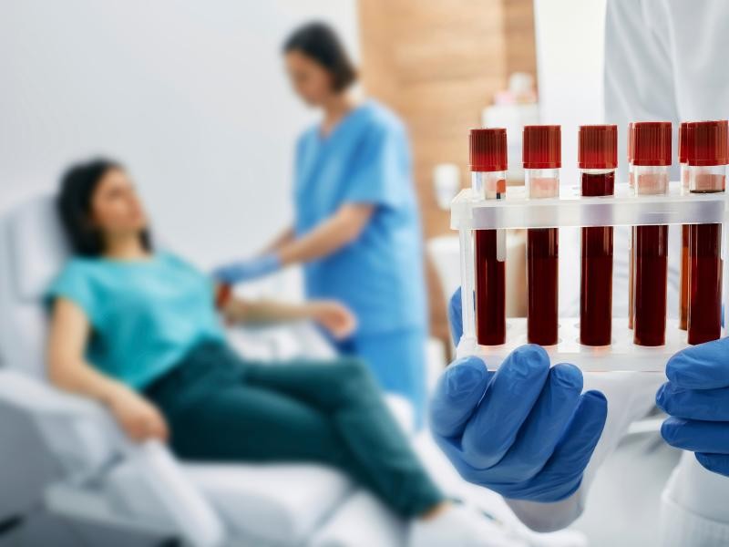 Como se preparar para exames laboratoriais e evitar erros