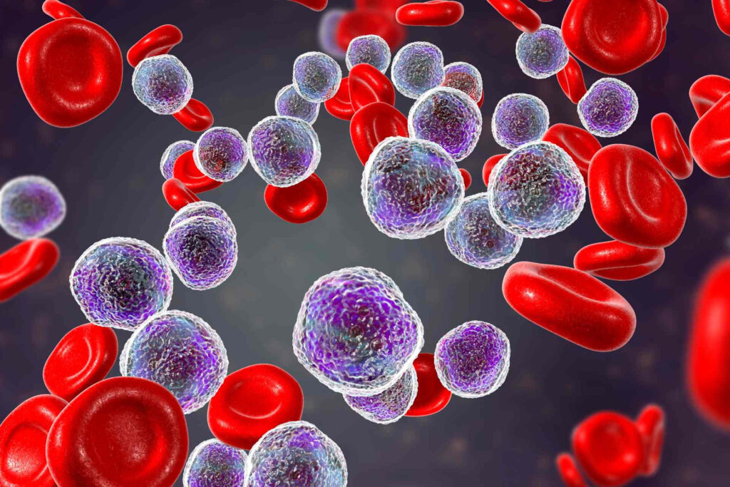 Fevereiro Laranja: o que você precisa saber sobre leucemia?