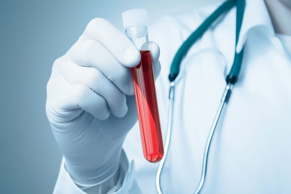 A importância dos exames laboratoriais para a saúde e diagnóstico médico