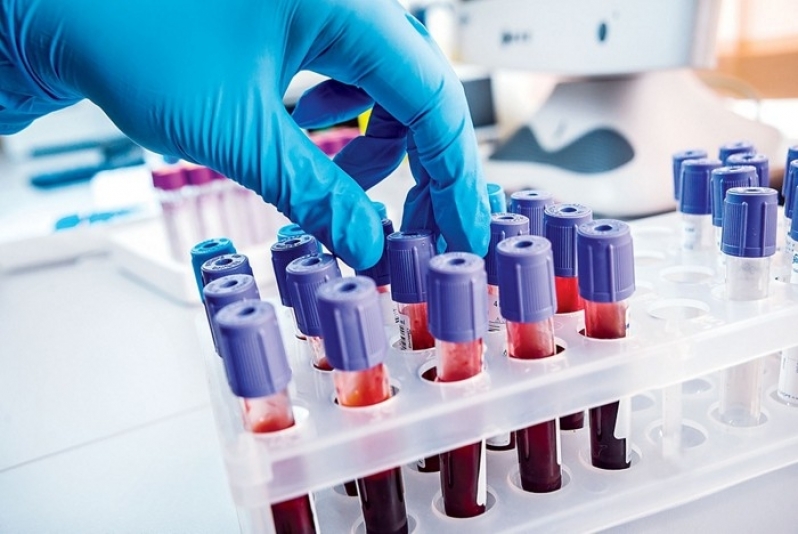 A importância dos exames laboratoriais para a saúde e diagnóstico médico