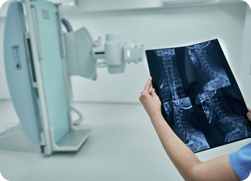 
Mãos, vestindo uma luva hospitalar clara ou pele clara, seguram uma chapa de Raio-X contra um fundo desfocado de uma sala de exames. A chapa exibe múltiplas imagens da coluna cervical (pescoço) e parte da coluna torácica de um paciente. Ao fundo, fora de foco, está o equipamento de radiografia ou Raio-X. A imagem foca no resultado do exame, que é a visualização da estrutura óssea.