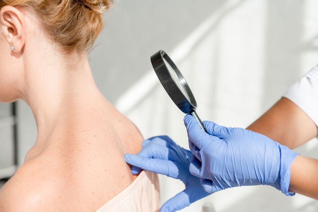 Dermatologista: conheça mais sobre o especialista em pele